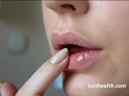 Môi thâm là bệnh gì