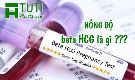 Chỉ số beta HCG là gì