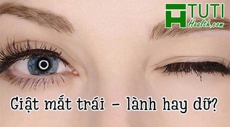 Bị nháy mắt trái liên tục là điềm gì