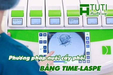 Phương pháp nuôi cấy phôi bằng time-lapse là gì